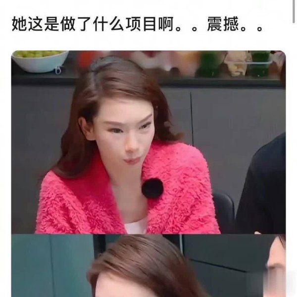 安福相册 戚薇回答眼部争议，真挚气派再获粉丝心