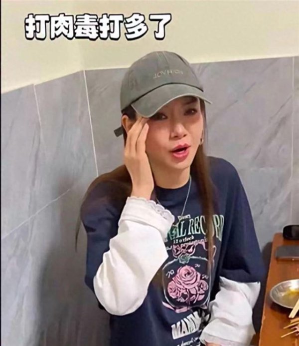 莆田安福相册 戚薇大方承认眼睛变形因肉毒针未收复，贴心指示粉丝严慎
