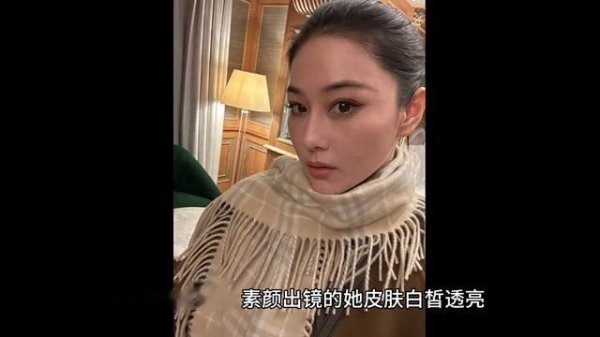 莆田安福家园 张馨予晒照秀自然发际线，毫无东谈主工踪迹宛如天生