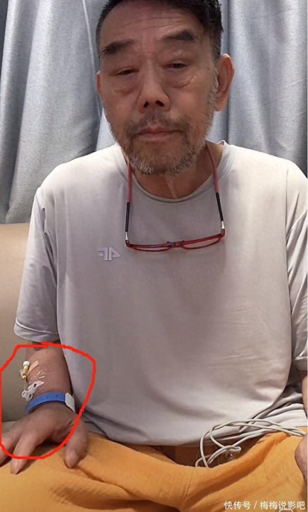 安福相册 杨伦带留置针开播，胡子拉碴气色差，杨议一句话拆台：你别装了！