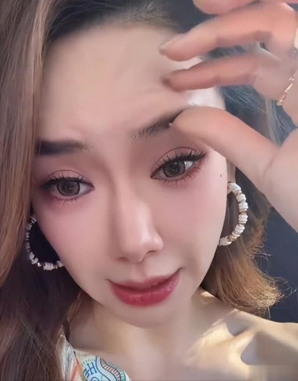 莆田安福相册 女星戚薇大方回话“吊梢眼”：打肉毒致眉毛僵成扑克脸！